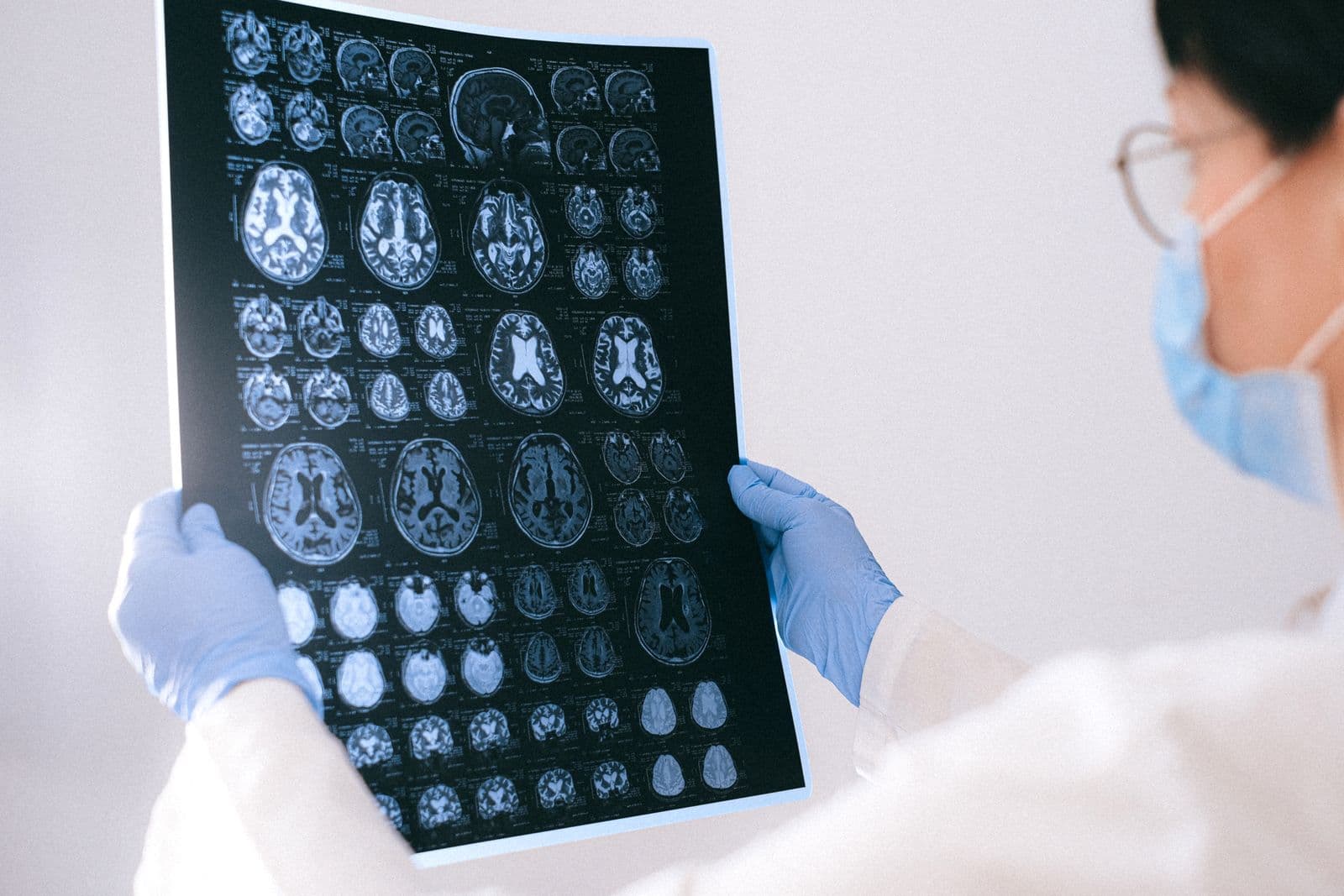 A medical professional reviewing MRI brain scans in a clinical setting
